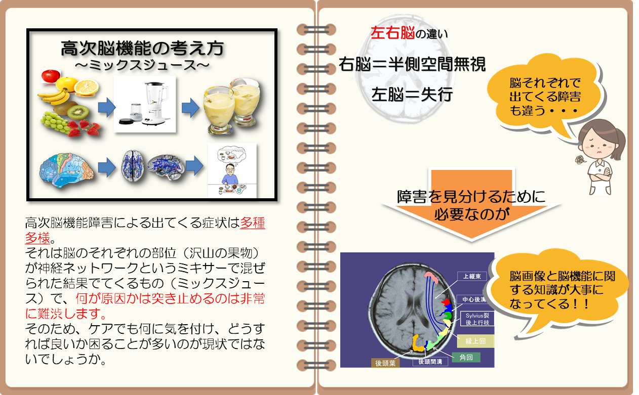 脳 と 機能 は 次 高 障害